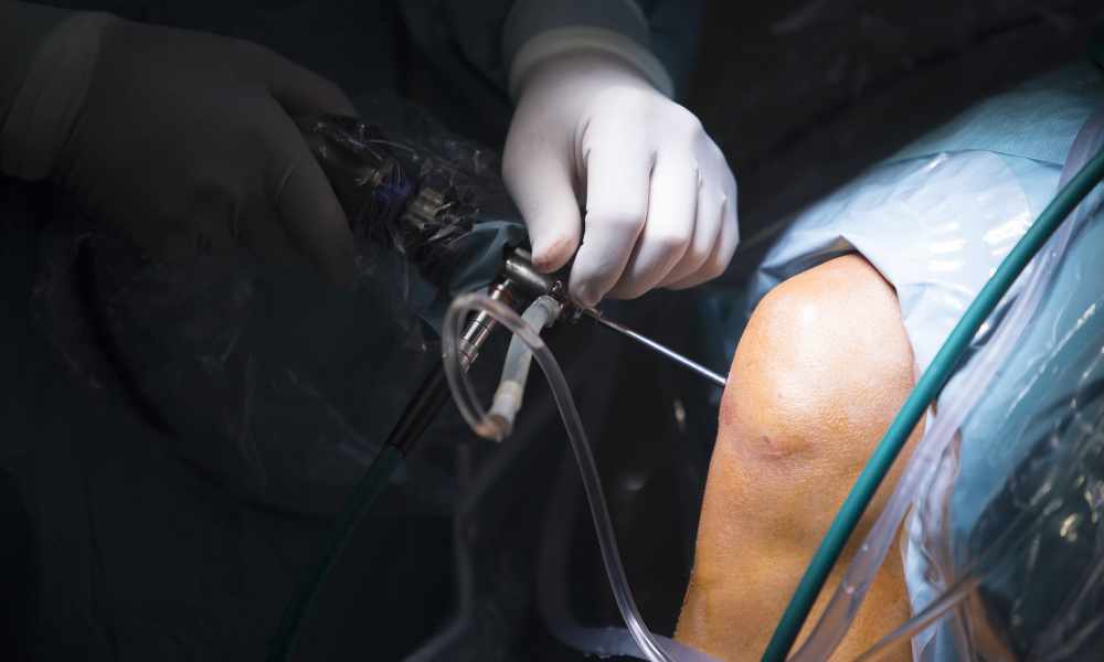 Best Arthroscopy Surgeon performing minimally invasive arthroscopy procedure